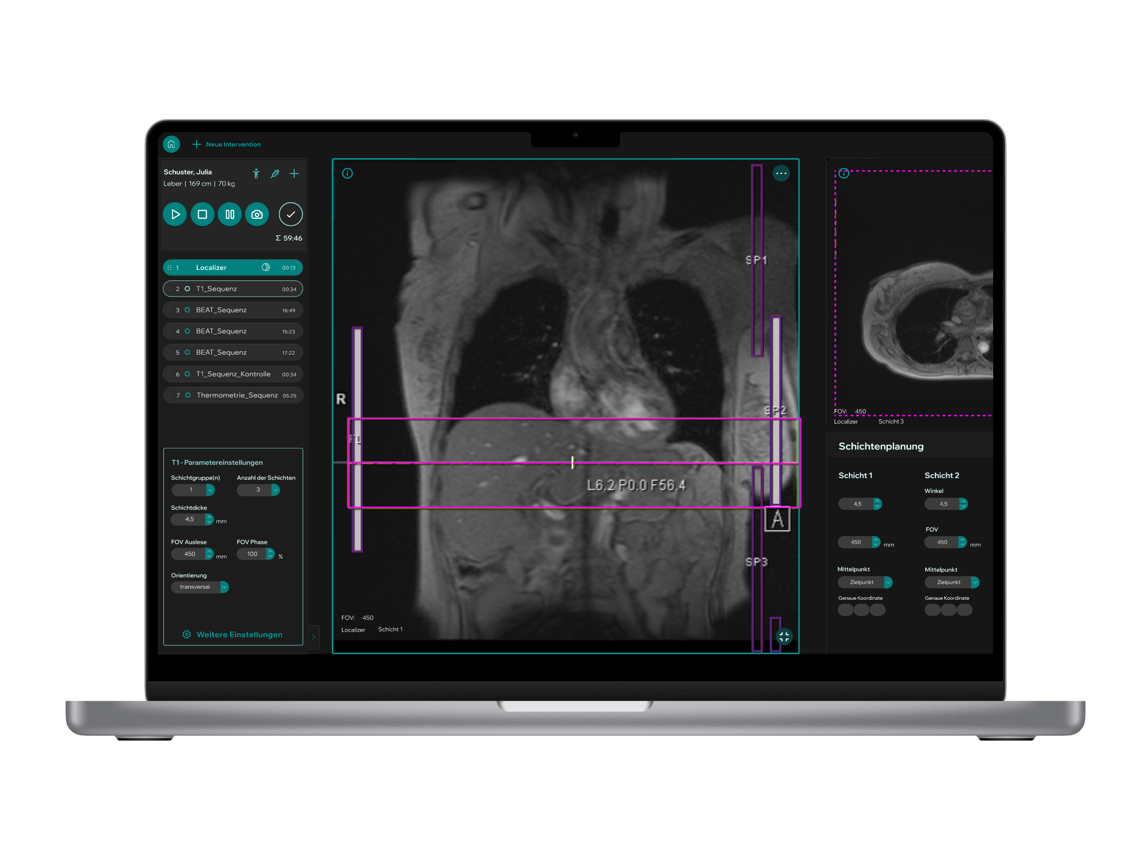 User Interface Demonstrator