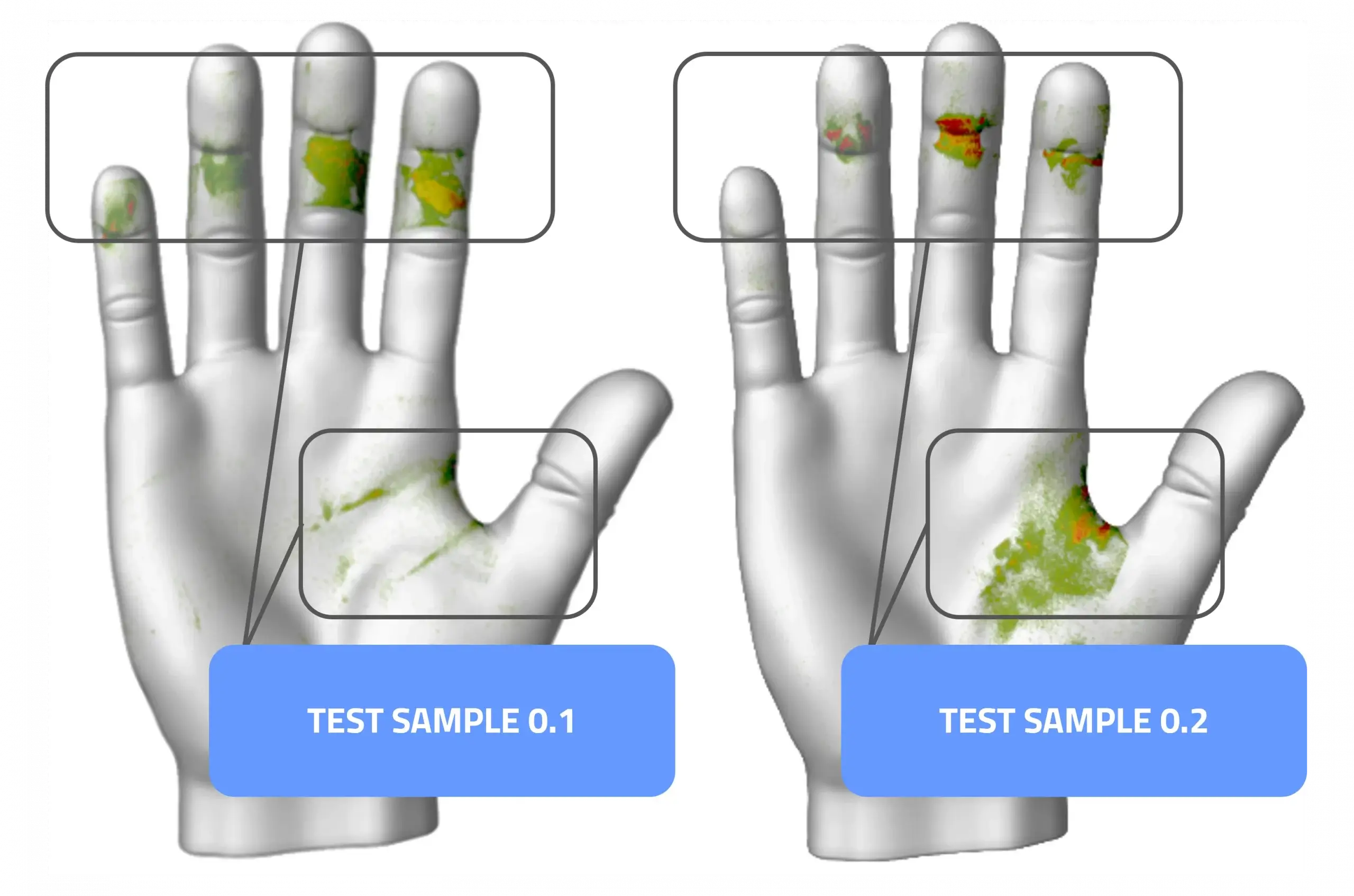 Aesculap pressure distribution visualisation