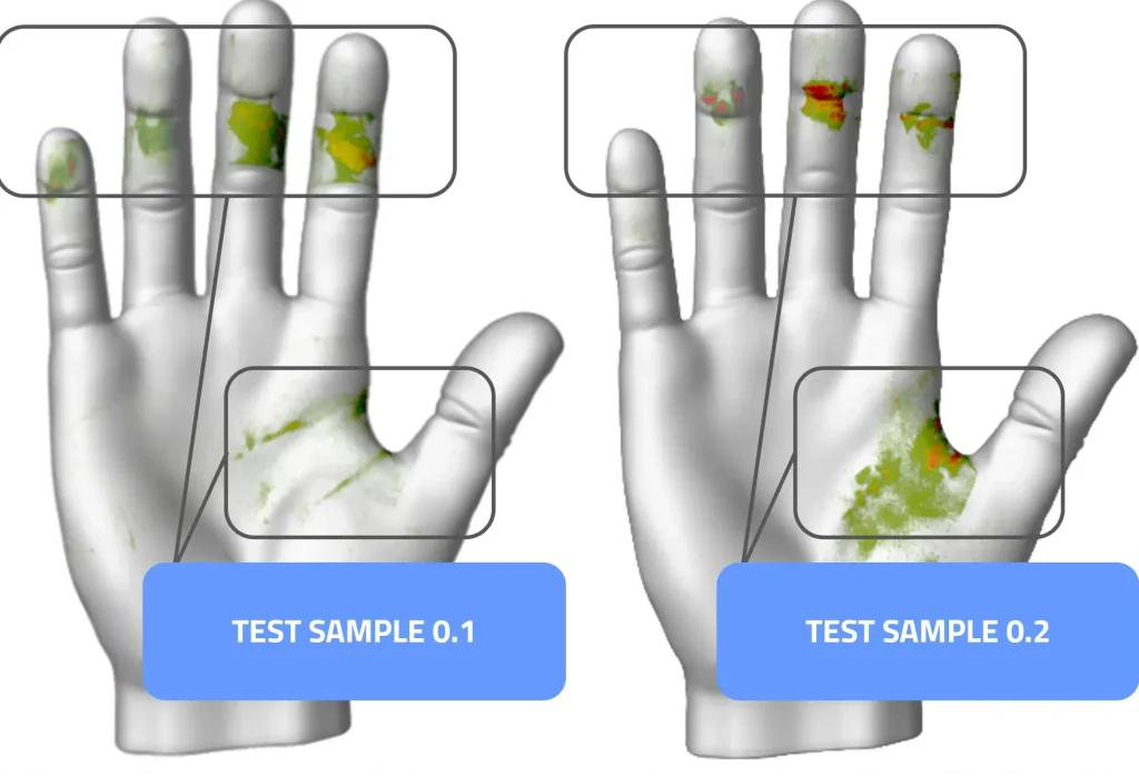 Aesculap pressure mapping - pressure distribution